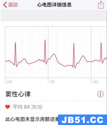 apple watch怎么看心电图