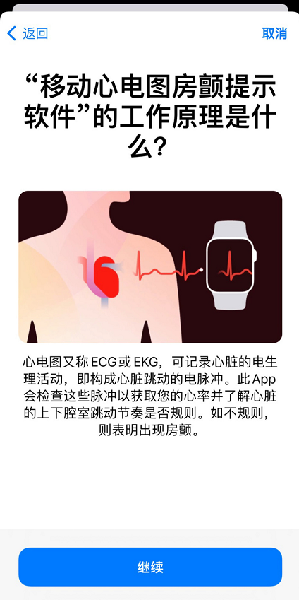 apple watch 心电图怎么用