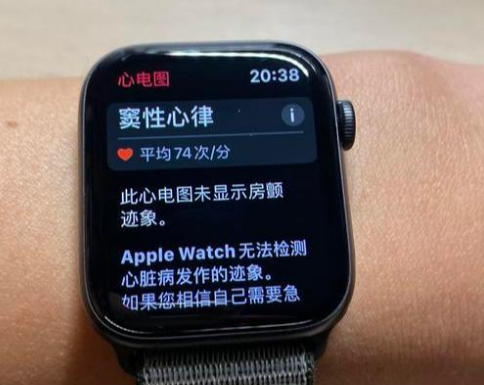 apple watch 心电图怎么用