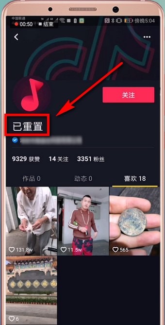 抖音短将重置恢复的具体操作流程是什么?